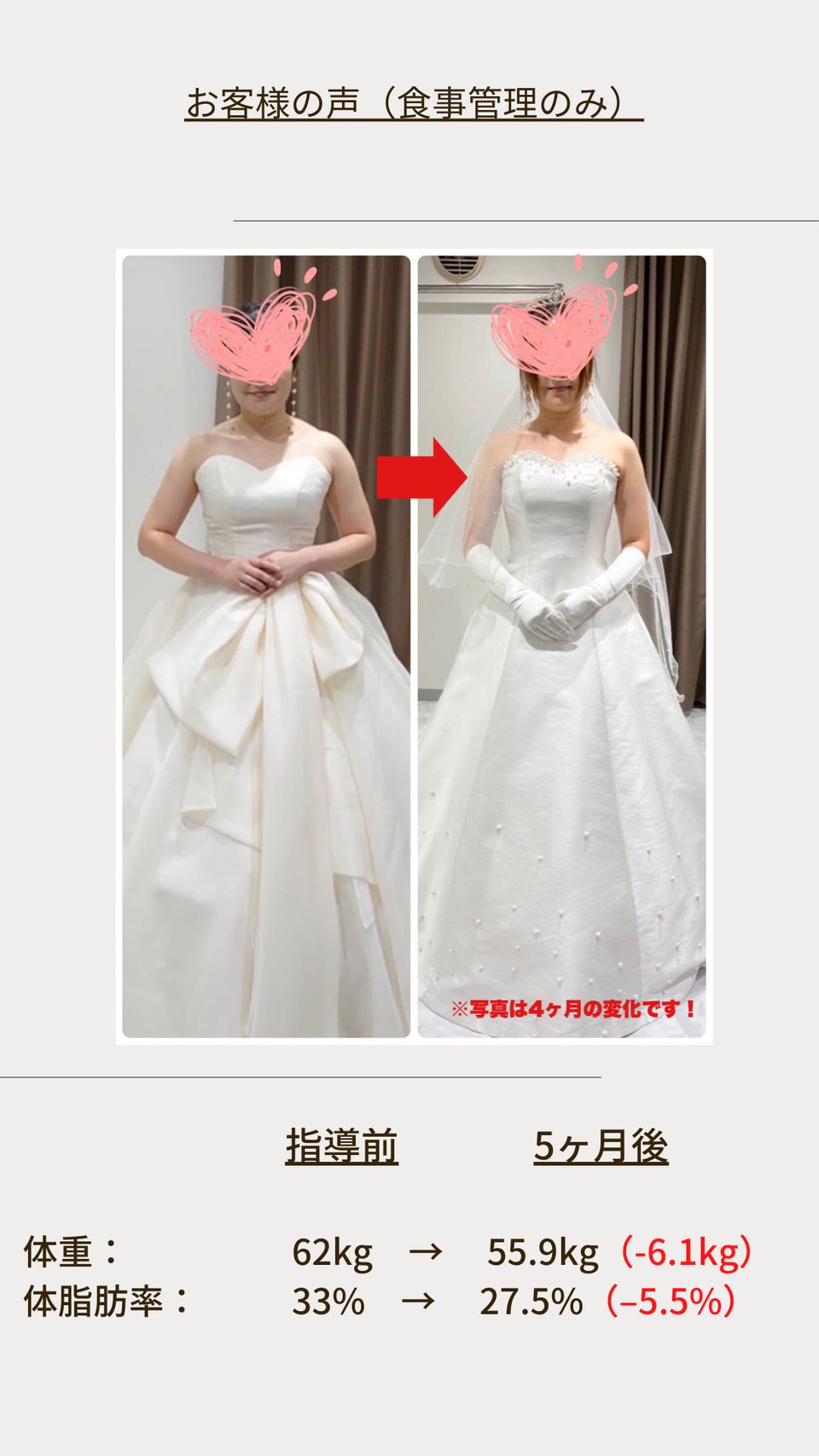 ウェディングドレス姿のビフォーアフター写真（お顔は隠しています）
